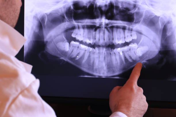 Best Emergency Treatment for Dental Infections or Abscesses in Ruhenstroth, NV