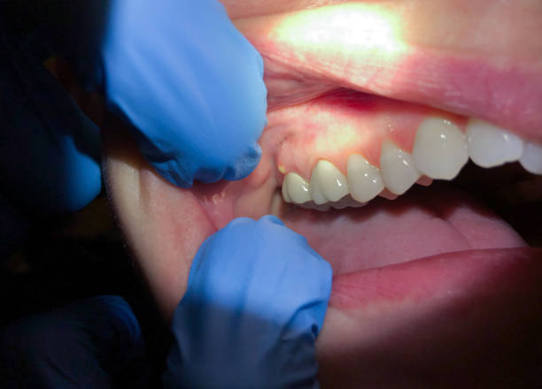 Best Emergency TMJ Treatment in Ruhenstroth, NV
